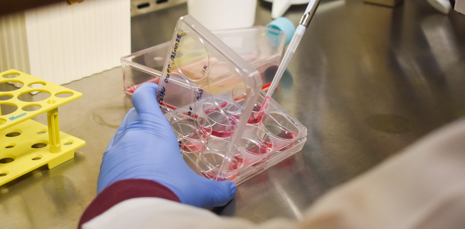 Gloved hands use a pipette with red liquid