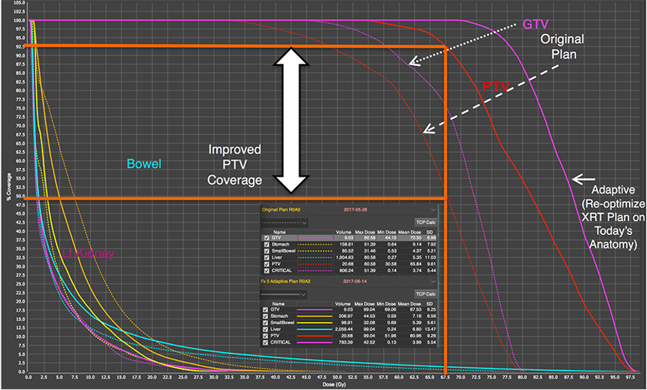Research figure for Adaptive radiotherapy