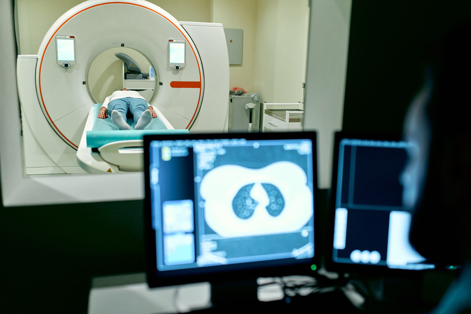 patient lying down undergoes an MRI or CT Scan