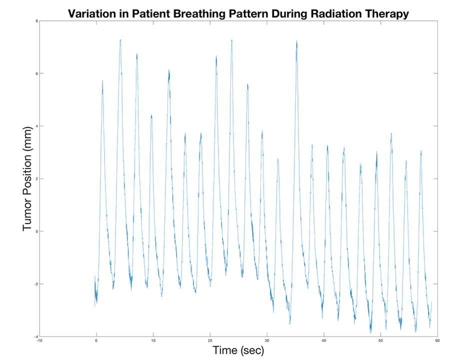 chart showing breathing patterns