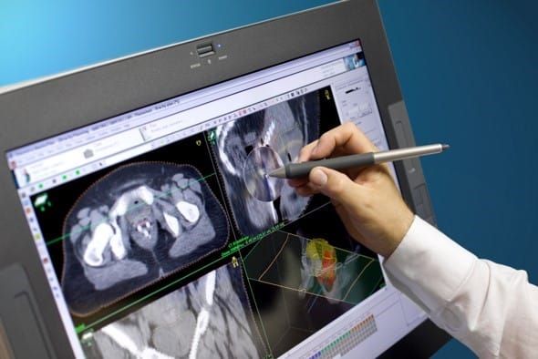 Oncentra treatment planning software screenshot