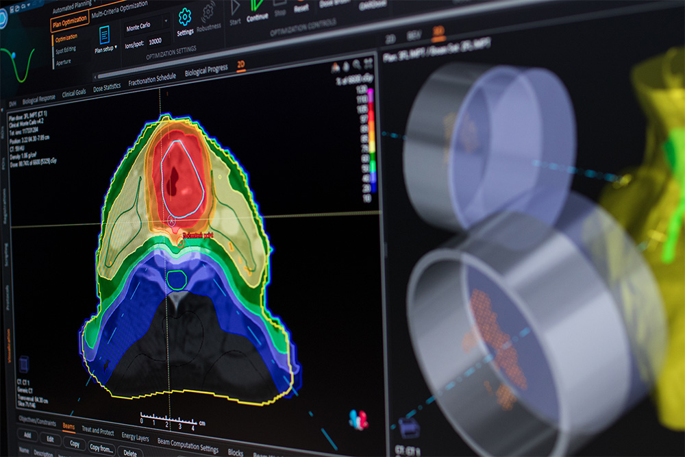 Raycare treatment planning