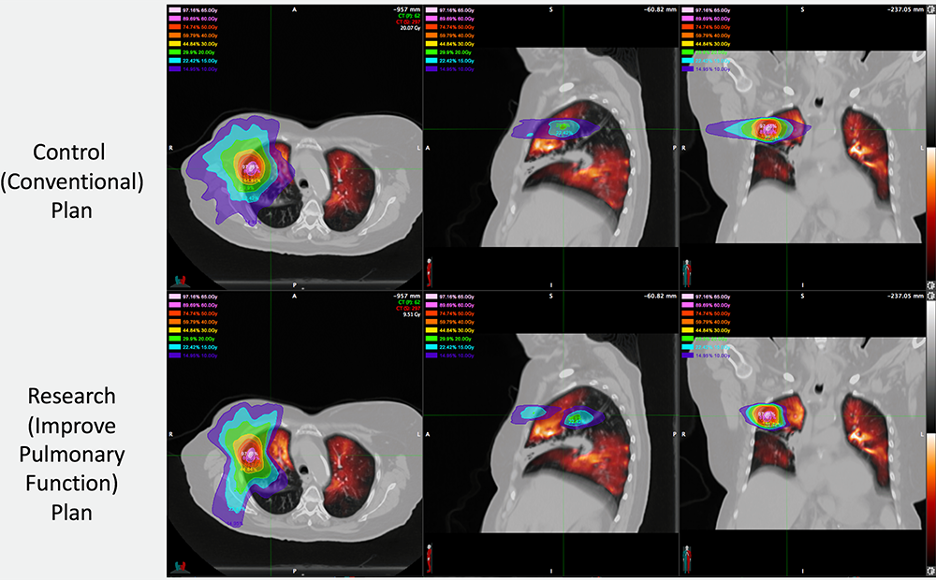 6 scans of patient's lungs